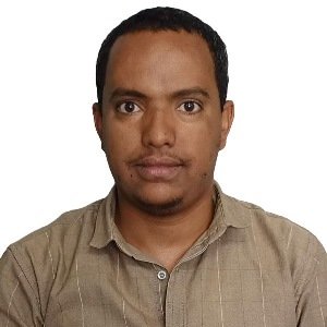 PREVALENCE AND PROFILE OF PULMONARY FUNGAL PATHOGENS AMONG HIV-INFECTED PATIENTS ATTENDING ALERT HOSPITAL, ADDIS ABABA ETHIOPIA